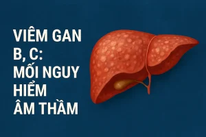 Viêm gan B, C: Mối Nguy Hiểm Âm Thầm Dẫn Tới Xơ Gan, Ung Thư Gan